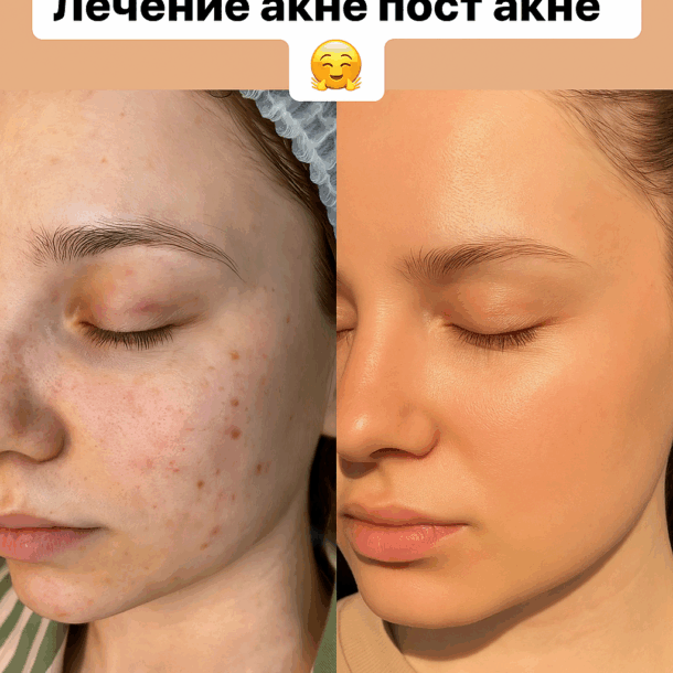 До и после